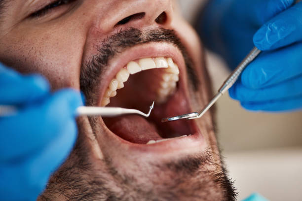 Best Knocked-Out Tooth Emergency  in South Pittsburg, TN